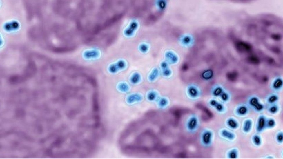 গনোরিয়ার জীবাণু