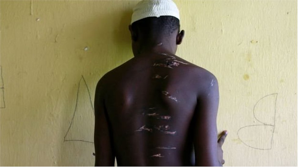 ১৫ বছর বয়সী এই কিশোর দেখাচ্ছেন কিভাবে তাকে প্রহার করা হয়েছে