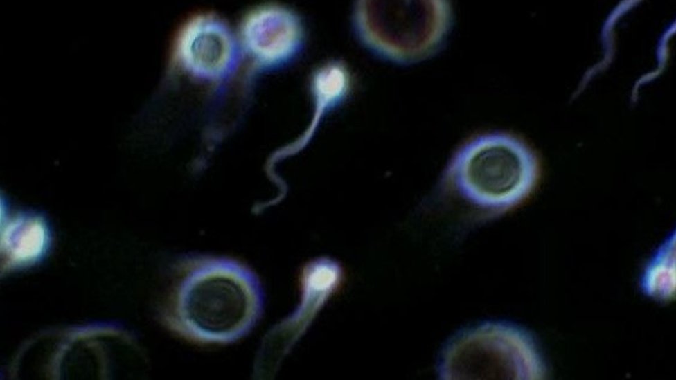 বায়ুদূষণ থেকে শুরু করে জীবনযাপন পদ্ধতি পর্যন্ত অনেক কিছুই শুক্রাণুর স্বাস্থ্যের ওপর প্রভাব ফেলতে পারে। বায়ুদূষণ থেকে শুরু করে জীবনযাপন পদ্ধতি পর্যন্ত অনেক কিছুই শুক্রাণুর স্বাস্থ্যের ওপর প্রভাব ফেলতে পারে।