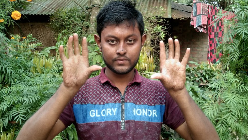অপু সরকার