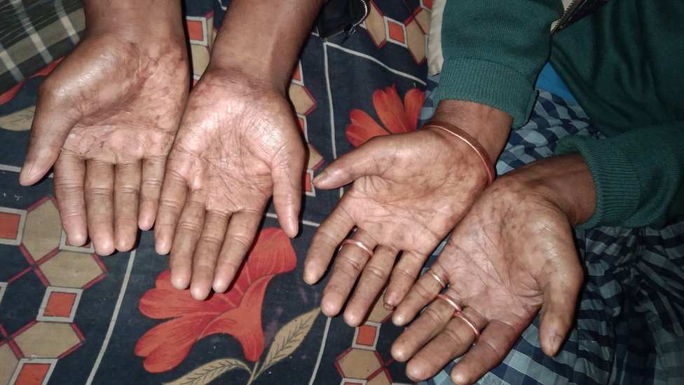 অমল সরকার এবং অপু সরকারের হাত