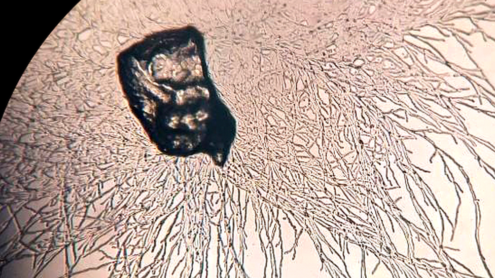 ইলেকট্রন মাইক্রোস্কোপে দেখা যাচ্ছে ফাংগাসের প্লাস্টিক খাওয়ার দৃশ্য