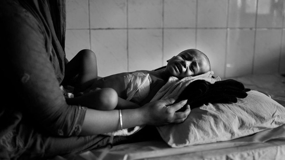 শিশুদের যক্ষ্মার চিকিৎসা উপেক্ষিত হওয়ার ঝুঁকি রয়েছে।