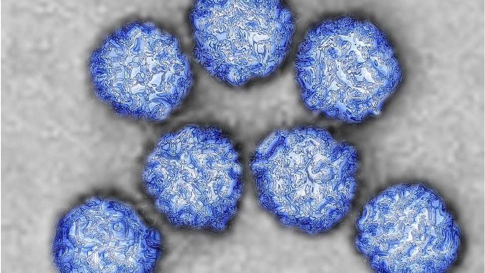 টমেটো ফ্লু